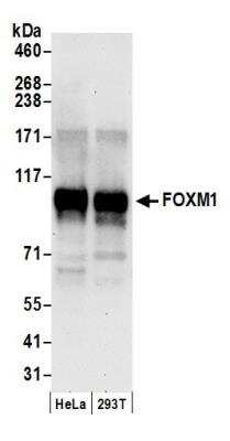 Western Blot: FoxM1 Antibody [NB100-74660]