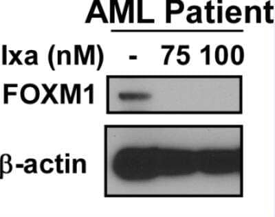 Western Blot: FoxM1 Antibody [NBP1-84671]