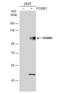 Western Blot: FoxM1 Antibody [NBP2-16519]