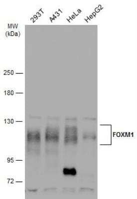 Western Blot: FoxM1 Antibody [NBP2-16519]