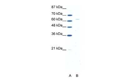 Western Blot: FoxN1 Antibody [NBP2-88822]