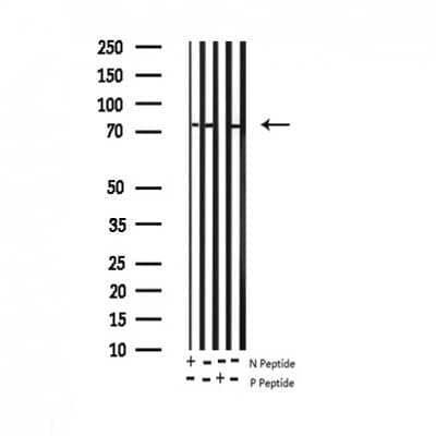 Western Blot: FoxO1/FKHR [p Ser256] Antibody [NB100-81927]