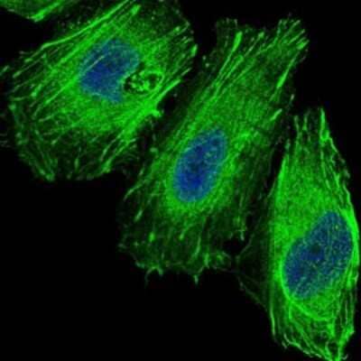 Immunocytochemistry/ Immunofluorescence: FoxO1/FKHR Antibody (3B6) - BSA Free [NBP2-22190]