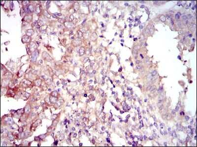 Immunohistochemistry-Paraffin: FoxO1/FKHR Antibody (3B6) - BSA Free [NBP2-22190]