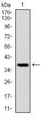 Western Blot: FoxO1/FKHR Antibody (3B6)BSA Free [NBP2-22190]