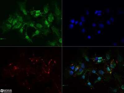Immunocytochemistry/ Immunofluorescence: FoxO1/FKHR Antibody (83N7F8) - Azide and BSA Free [NBP2-80741]