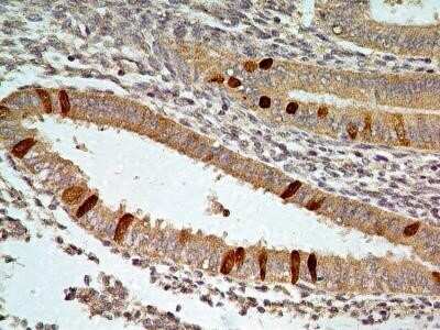 Immunohistochemistry: FoxO1/FKHR Antibody (83N7F8) - Azide and BSA Free [NBP2-80741]