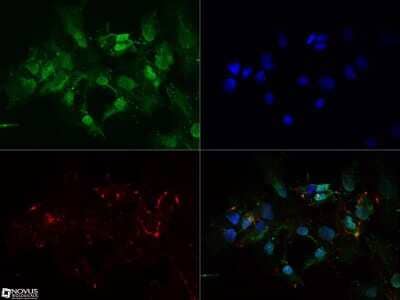 Immunocytochemistry/ Immunofluorescence: FoxO1/FKHR Antibody (83N7F8) - BSA Free [NBP2-31376]