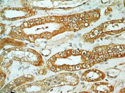Immunohistochemistry-Paraffin: FoxO1/FKHR Antibody (83N7F8) - BSA Free [NBP2-31376]
