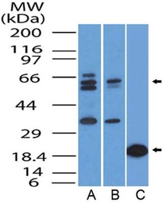 Western Blot: FoxO1/FKHR Antibody (83N7F8)BSA Free [NBP2-31376]