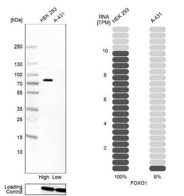 Western Blot: FoxO1/FKHR Antibody (CL13278) [NBP3-18557]