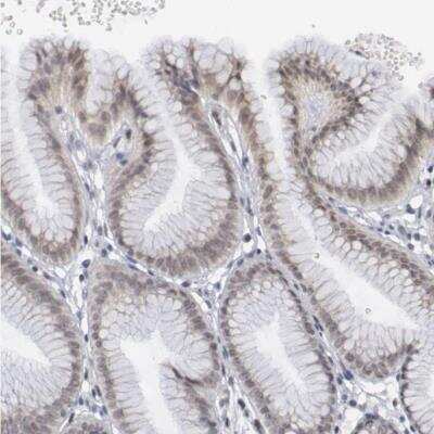 Immunohistochemistry-Paraffin: FoxO1/FKHR Antibody [NBP1-84674]