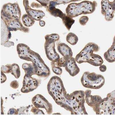 Immunohistochemistry-Paraffin: FoxO1/FKHR Antibody [NBP1-84674]