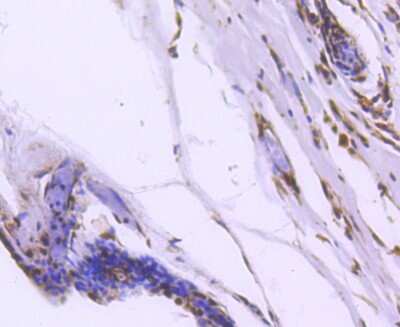 Immunohistochemistry-Paraffin: FoxO1/FKHR Antibody (SU33-01) [NBP2-67463]