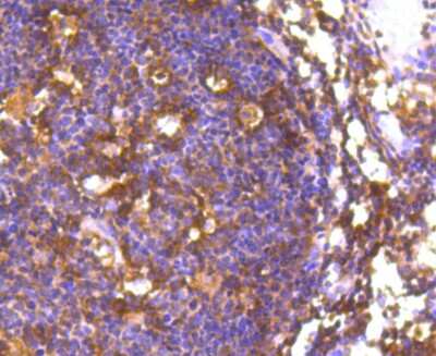Immunohistochemistry-Paraffin: FoxO1/FKHR Antibody (SU33-01) [NBP2-67463]