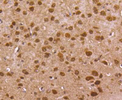Immunohistochemistry-Paraffin: FoxO1/FKHR Antibody (SU33-01) [NBP2-67463]