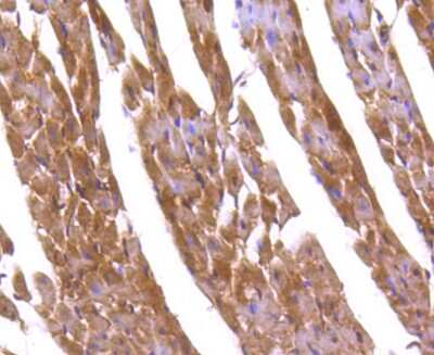 Immunohistochemistry-Paraffin: FoxO1/FKHR Antibody (SU33-01) [NBP2-67463]