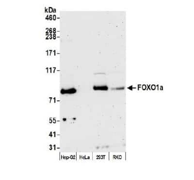 Western Blot: FoxO1/FKHR Antibody [NB100-2312]