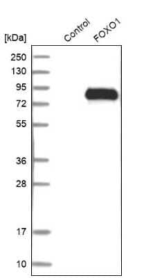 Western Blot: FoxO1/FKHR Antibody [NBP1-84674]