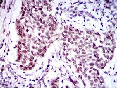 Immunohistochemistry: FoxP1 Antibody (6E4) - BSA Free [NBP2-37450]