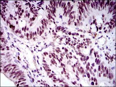Immunohistochemistry: FoxP1 Antibody (6E4) - BSA Free [NBP2-37450]