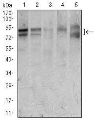 Western Blot: FoxP1 Antibody (6E4)BSA Free [NBP2-37450]