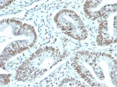 Immunohistochemistry-Paraffin: FoxP1 Antibody (FOXP1/44R) - Azide and BSA Free [NBP3-08470]