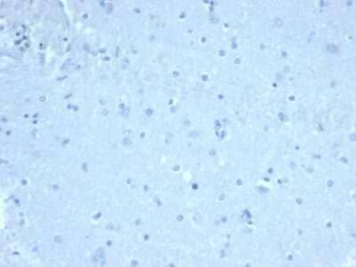 Immunohistochemistry-Paraffin: FoxP1 Antibody (FOXP1/44R) - Azide and BSA Free [NBP3-08470]