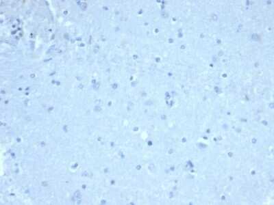 Immunohistochemistry-Paraffin: FoxP1 Antibody (FOXP1/44R) [NBP3-07297]