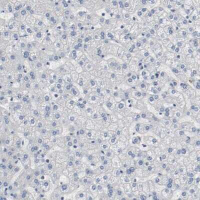 Immunohistochemistry-Paraffin: FoxP1 Antibody [NBP1-89410]