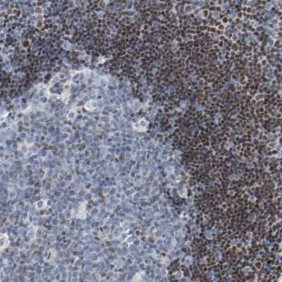 Immunohistochemistry-Paraffin: FoxP1 Antibody [NBP1-89410]