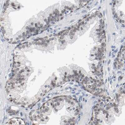Immunohistochemistry-Paraffin: FoxP1 Antibody [NBP1-89410]