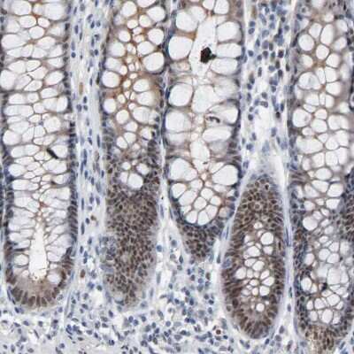 Immunohistochemistry-Paraffin: FoxP1 Antibody [NBP1-89410]