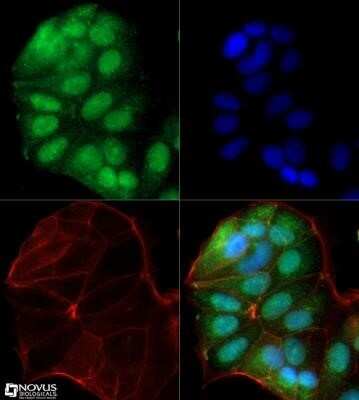 Immunocytochemistry/ Immunofluorescence: FoxP1 Antibody (JC12) - Azide and BSA Free [NBP2-80742]
