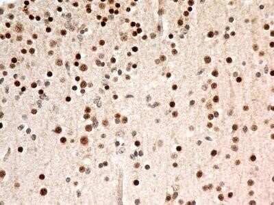 Immunohistochemistry: FoxP1 Antibody (JC12) - Azide and BSA Free [NBP2-80742]