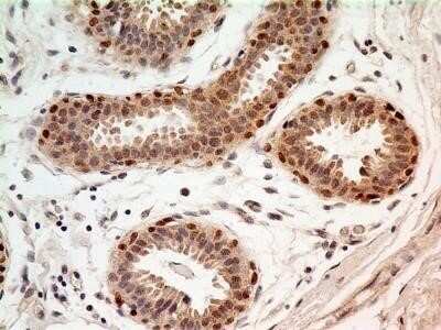 Immunohistochemistry-Paraffin: FoxP1 Antibody (JC12) - Azide and BSA Free [NBP2-80742]