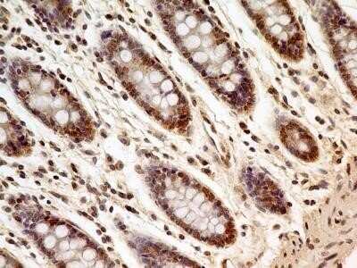 Immunohistochemistry-Paraffin: FoxP1 Antibody (JC12) - Azide and BSA Free [NBP2-80742]