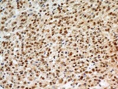 Immunohistochemistry-Paraffin: FoxP1 Antibody (JC12) - Azide and BSA Free [NBP2-80742]