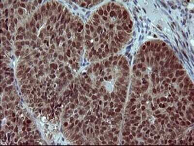 Immunohistochemistry: FoxP1 Antibody (OTI4F1) - Azide and BSA Free [NBP2-71831]
