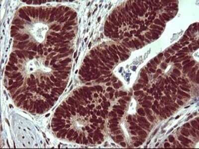 Immunohistochemistry: FoxP1 Antibody (OTI4F1) - Azide and BSA Free [NBP2-71831]