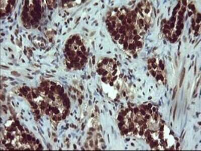 Immunohistochemistry: FoxP1 Antibody (OTI4F1) - Azide and BSA Free [NBP2-71831]