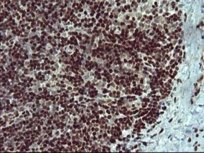 Immunohistochemistry: FoxP1 Antibody (OTI4F1) - Azide and BSA Free [NBP2-71831]