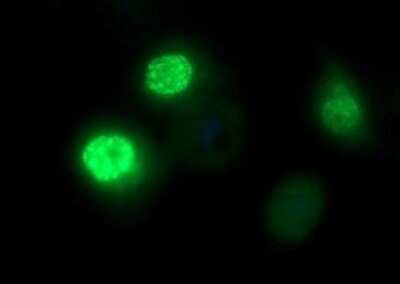 Immunofluorescence: FoxP1 Antibody (OTI4F1) [NBP2-45713]