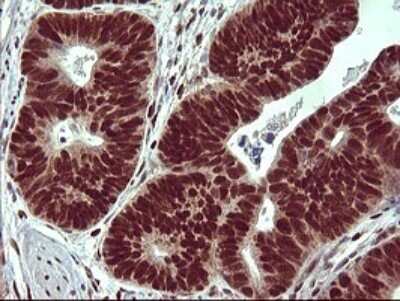 Immunohistochemistry: FoxP1 Antibody (OTI4F1) [NBP2-45713]