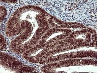 Immunohistochemistry: FoxP1 Antibody (OTI4F1) [NBP2-45713]
