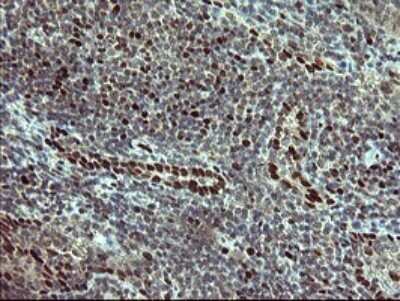 Immunohistochemistry: FoxP1 Antibody (OTI4F1) [NBP2-45713]
