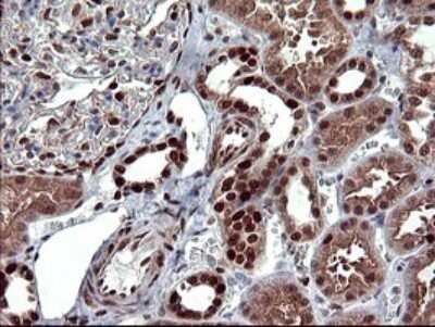 Immunohistochemistry: FoxP1 Antibody (OTI4F1) [NBP2-45713]
