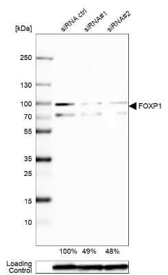 Western Blot: FoxP1 Antibody [NBP1-89410]