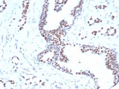 Immunohistochemistry-Paraffin: FoxP1 Antibody (rFOXP1/6902) [NBP3-13927]