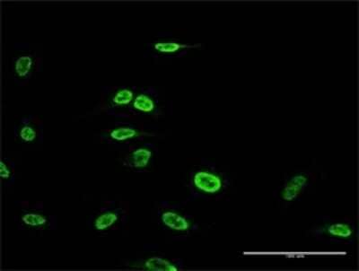 Immunocytochemistry/ Immunofluorescence: FoxP2 Antibody (1F8) [H00093986-M02]